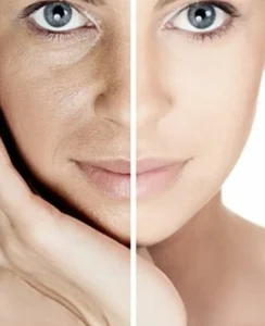 Split face skincare image comparing dry skin and dehydrated skin with visible texture and hydration difference.